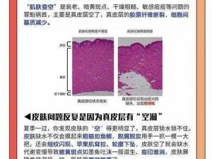 人类失误导致的灾难：深度定制皮肤困境揭秘