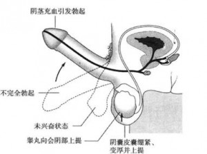 男性勃起整个过程无遮挡_男性勃起全过程，竟然如此神奇